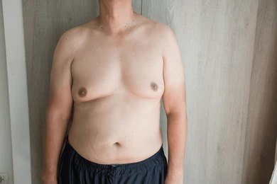 Chest Procedures